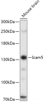 Immunofluorescence analysis of C6 cells using TSC2 Polyclonal Antibody at dilution of  1:100. Blue: DAPI for nuclear staining.
