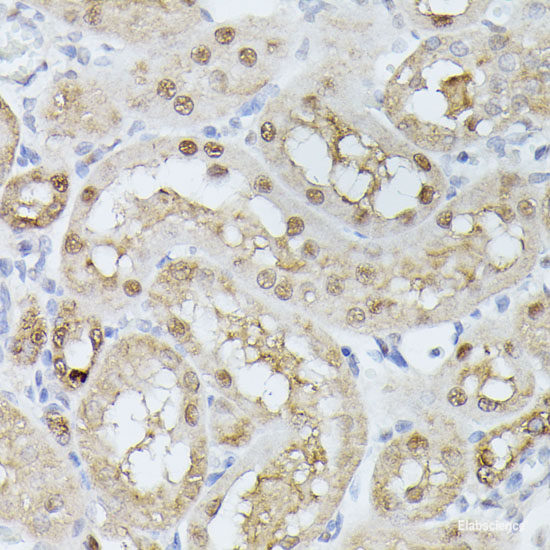 Immunofluorescence analysis of U2OS cells using MonoMethyl-UHRF1-K385 Polyclonal Antibody at dilution of  1:100. Blue: DAPI for nuclear staining.