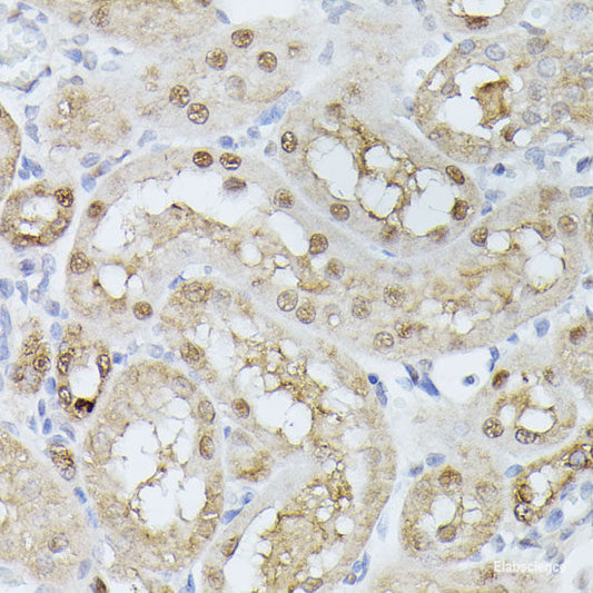 Immunofluorescence analysis of U2OS cells using MonoMethyl-UHRF1-K385 Polyclonal Antibody at dilution of  1:100. Blue: DAPI for nuclear staining.