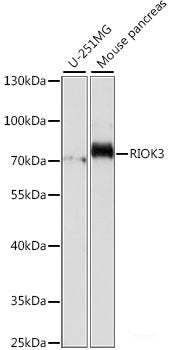 Immunofluorescence analysis of U2OS cells using SH2D1B Polyclonal Antibody at dilution of  1:100. Blue: DAPI for nuclear staining.