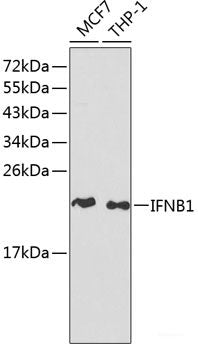 Immunofluorescence analysis of U2OS cells using HNRNPCL1 Polyclonal Antibody at dilution of  1:100. Blue: DAPI for nuclear staining.