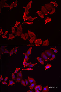 Immunofluorescence analysis of U2OS cells using DiMethyl-DNMT3A-K44 Polyclonal Antibody at dilution of  1:100. Blue: DAPI for nuclear staining.