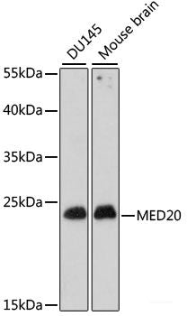 Immunohistochemistry of paraffin-embedded Human breast cancer using LAMC1 Polyclonal Antibody at dilution of  1:100 (40x lens).