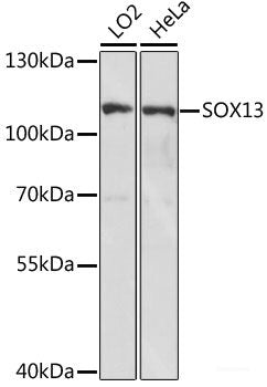Immunohistochemistry of paraffin-embedded Rat kidney using RARB Polyclonal Antibody at dilution of  1:100 (40x lens).