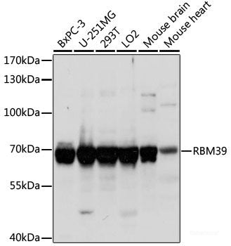 Immunofluorescence analysis of L929 cells using ABCD2 Polyclonal Antibody at dilution of  1:100 (40x lens). Blue: DAPI for nuclear staining.