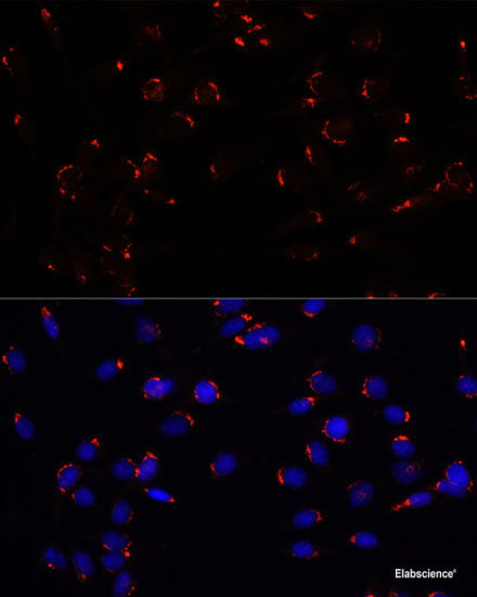 Immunohistochemistry of paraffin-embedded Rat ovary using ASNS Polyclonal Antibody at dilution of  1:100 (40x lens).