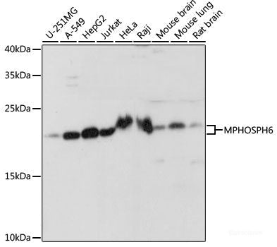 Immunohistochemistry of paraffin-embedded Human liver cancer using CRK Polyclonal Antibody at dilution of  1:200 (40x lens).