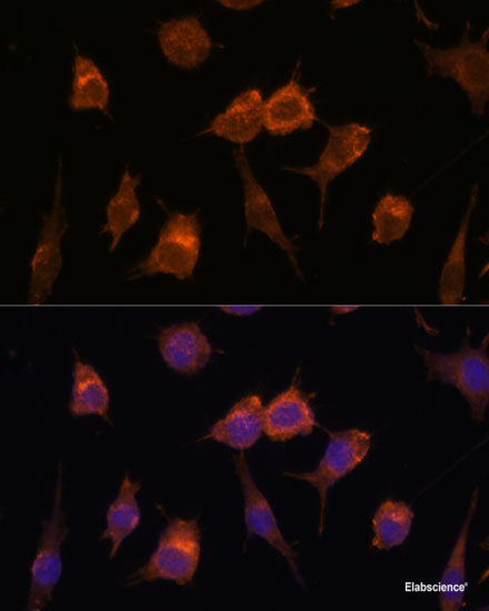 Immunofluorescence analysis of U-2 OS cells using HNF4G Polyclonal Antibody at dilution of  1:100 (40x lens). Blue: DAPI for nuclear staining.