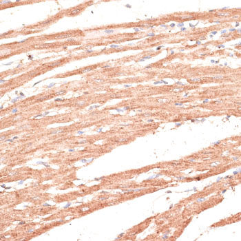 Immunohistochemistry of paraffin-embedded Rat brain using IGHMBP2 Polyclonal Antibody at dilution of  1:100 (40x lens).