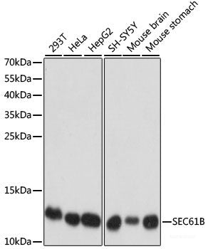Immunohistochemistry of paraffin-embedded Rat liver using MAP3K1 Polyclonal Antibody at dilution of  1:100 (40x lens).