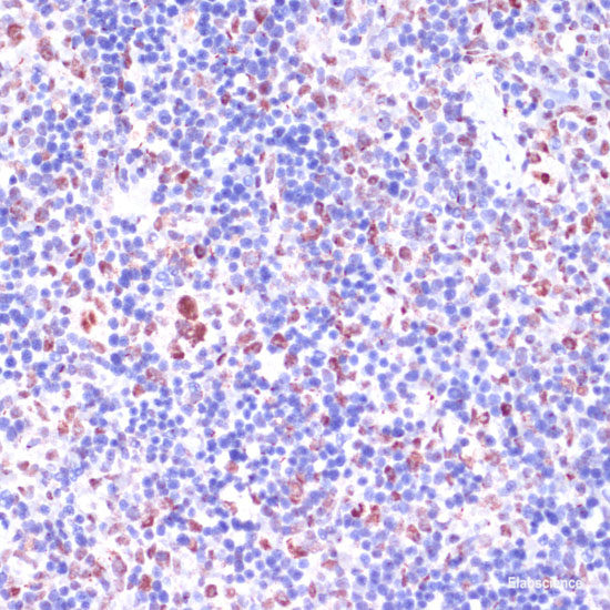 Immunohistochemistry of paraffin-embedded Rat ovary using TRIM27 Polyclonal Antibody at dilution of  1:100 (40x lens).