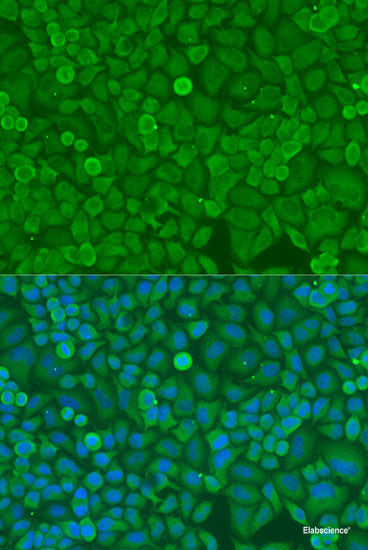 Immunohistochemistry of paraffin-embedded Rat brain using SLC18A3 Polyclonal Antibody at dilution of  1:200 (40x lens).