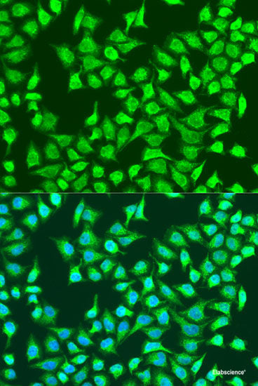 Immunohistochemistry of paraffin-embedded Rat lymph node using CCDC6 Polyclonal Antibody at dilution of  1:100 (40x lens).