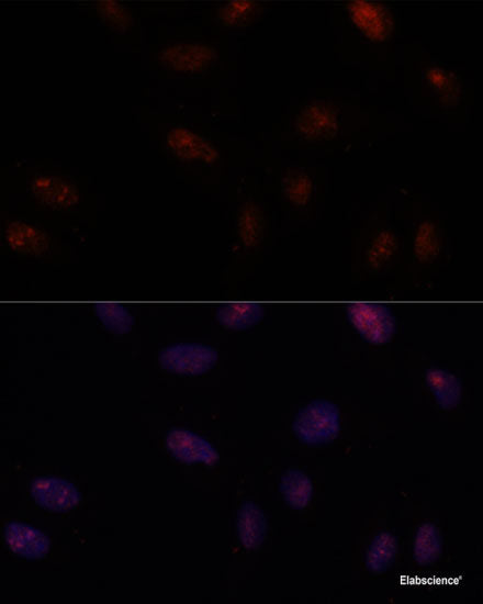 Immunohistochemistry of paraffin-embedded Rat liver using MLF2 Polyclonal Antibody at dilution of  1:100 (40x lens).