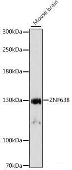 Immunofluorescence analysis of C6 cells using SYCP2 Polyclonal Antibody at dilution of  1:100. Blue: DAPI for nuclear staining.