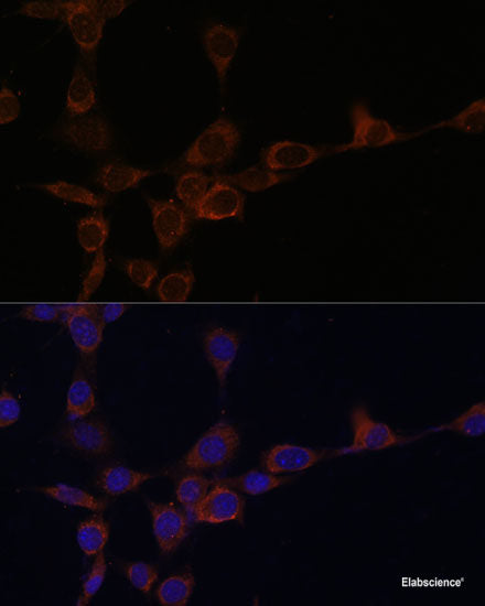 Immunohistochemistry of paraffin-embedded tonsil using HLA-DRB3 Polyclonal Antibody at dilution of  1:100 (40x lens).