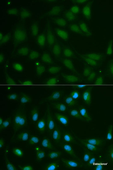 Immunohistochemistry of paraffin-embedded Rat Intestine using SPARC Polyclonal Antibody at dilution of  1:100 (40x lens).