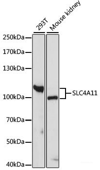 Immunofluorescence analysis of C6 cells using NDRG4 Polyclonal Antibody at dilution of  1:100. Blue: DAPI for nuclear staining.