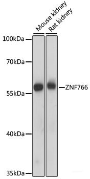 Immunohistochemistry of paraffin-embedded Rat brain using KIAA1429 Polyclonal Antibody at dilution of  1:100 (40x lens).