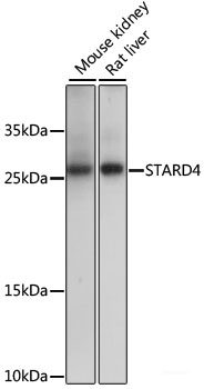 Immunofluorescence analysis of L929 cells using KCNAB2 Polyclonal Antibody at dilution of  1:100. Blue: DAPI for nuclear staining.
