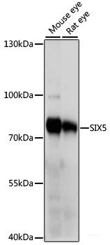 Immunohistochemistry of paraffin-embedded Human tonsil using CSNK1A1 Polyclonal Antibody at dilution of  1:100 (40x lens).