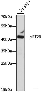 Immunofluorescence analysis of C6 cells using LPL Polyclonal Antibody at dilution of  1:100. Blue: DAPI for nuclear staining.