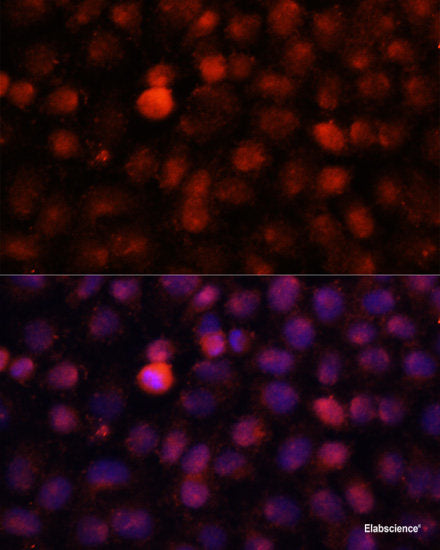 Immunohistochemistry of paraffin-embedded Human lung using WASF3 Polyclonal Antibody at dilution of  1:100 (40x lens).