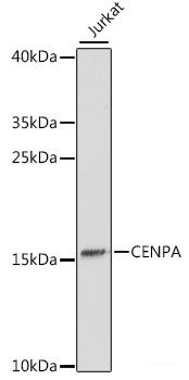 Immunohistochemistry of paraffin-embedded Human lung cancer using CDX2 Polyclonal Antibody at dilution of  1:100 (40x lens).