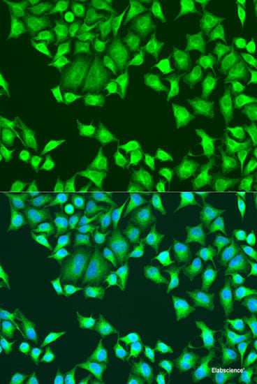 Immunohistochemistry of paraffin-embedded Human small intestine using HMGCR Polyclonal Antibody at dilution of  1:200 (40x lens).
