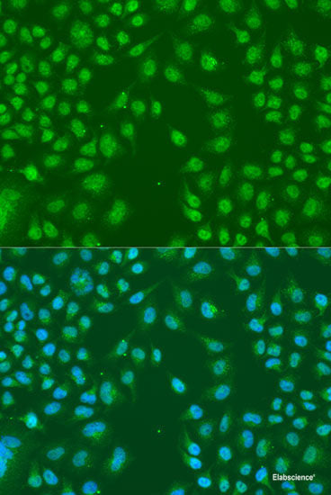 Immunohistochemistry of paraffin-embedded Mouse liver using COMP Polyclonal Antibody at dilution of  1:100 (40x lens).