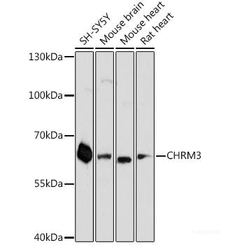 Immunohistochemistry of paraffin-embedded Human placenta using A2M Polyclonal Antibody at dilution of  1:100 (40x lens).