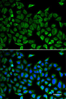 Immunofluorescence analysis of C6 cells using AEBP1 Polyclonal Antibody at dilution of  1:100 (40x lens). Blue: DAPI for nuclear staining.