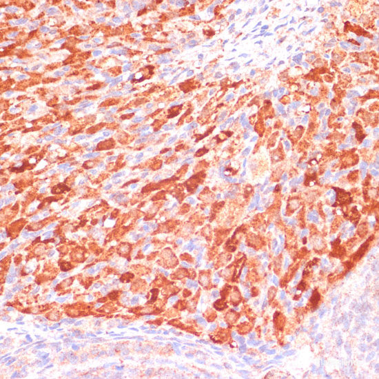 Immunofluorescence analysis of HeLa cells using ARF1 Polyclonal Antibody at dilution of  1:100. Blue: DAPI for nuclear staining.