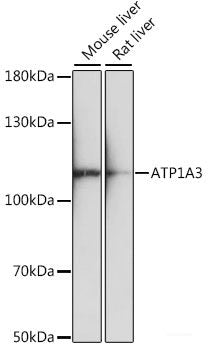 Immunofluorescence analysis of HeLa cells using ARAF Polyclonal Antibody at dilution of  1:100. Blue: DAPI for nuclear staining.