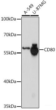 Immunofluorescence analysis of C6 cells using ARL3 Polyclonal Antibody at dilution of  1:100 (40x lens). Blue: DAPI for nuclear staining.