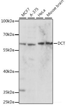 Immunohistochemistry of paraffin-embedded Human stomach using HMGA1 Polyclonal Antibody at dilution of  1:100 (40x lens).