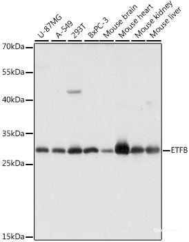 Immunofluorescence analysis of C6 cells using ATP6V0C Polyclonal Antibody at dilution of  1:100 (40x lens). Blue: DAPI for nuclear staining.