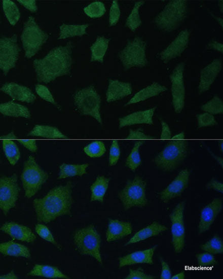 Immunofluorescence analysis of HeLa cells using BMP1 Polyclonal Antibody at dilution of  1:100. Blue: DAPI for nuclear staining.
