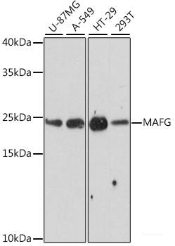 Immunohistochemistry of paraffin-embedded Rat lung using CYP11A1 Polyclonal Antibody at dilution of  1:100 (40x lens).