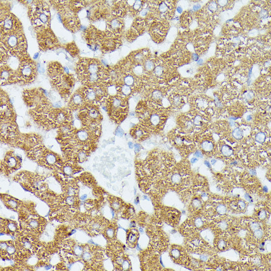 Immunohistochemistry of paraffin-embedded Human colon carcinoma using HBEGF Polyclonal Antibody at dilution of  1:100 (40x lens).