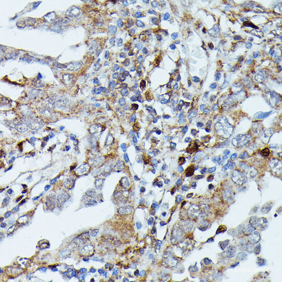 Immunofluorescence analysis of HeLa cells using ENO3 Polyclonal Antibody at dilution of  1:100. Blue: DAPI for nuclear staining.