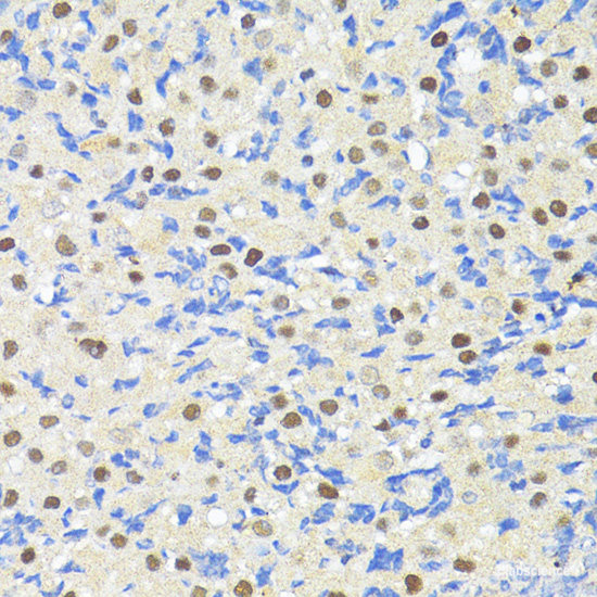 Immunohistochemistry of paraffin-embedded Rat heart using FLNA Polyclonal Antibody at dilution of  1:100 (40x lens).