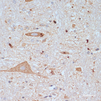 Immunohistochemistry of paraffin-embedded Rat testis using MSH6 Polyclonal Antibody at dilution of  1:100 (40x lens).