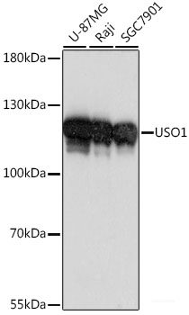 Immunohistochemistry of paraffin-embedded Human colon carcinoma using KRT13 Polyclonal Antibody at dilution of  1:100 (40x lens).