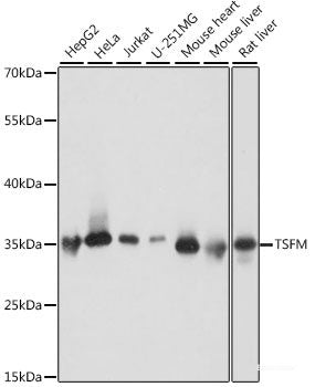 Immunohistochemistry of paraffin-embedded Mouse testis using CAMP Polyclonal Antibody at dilution of  1:200 (40x lens).
