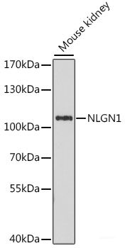 Immunofluorescence analysis of Mouse brain using NEFM Polyclonal Antibody at dilution of  1:100. Blue: DAPI for nuclear staining.