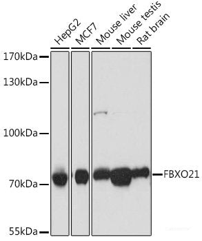 Immunohistochemistry of paraffin-embedded Human placenta using NMT1 Polyclonal Antibody at dilution of  1:100 (40x lens).