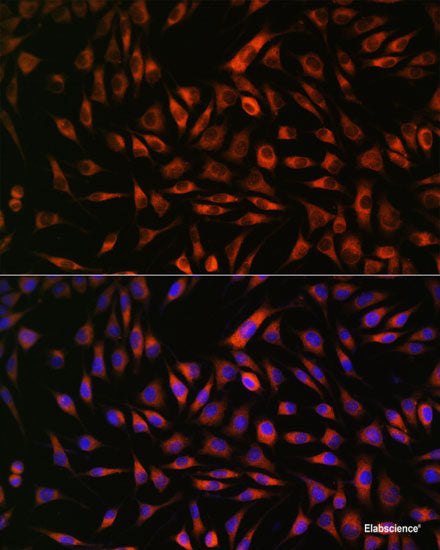 Immunofluorescence analysis of U-2 OS cells using PRSS8 Polyclonal Antibody at dilution of  1:100. Blue: DAPI for nuclear staining.