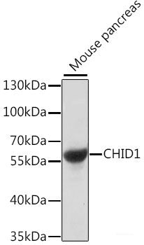 Immunohistochemistry of paraffin-embedded Rat liver using SAA4 Polyclonal Antibody at dilution of  1:100 (40x lens).