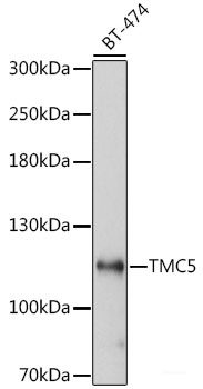 Immunohistochemistry of paraffin-embedded Rat lung using DEFB4A Polyclonal Antibody at dilution of  1:100 (40x lens).